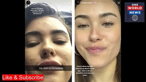 madison beer snap save video|Madison Beer Recalls Aftermath of Leaked Videos 